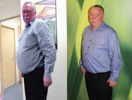 GI Dynamics extends Australian reach of EndoBarrier