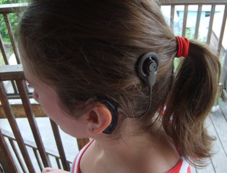 Cochlear record revenue fails to impress investors