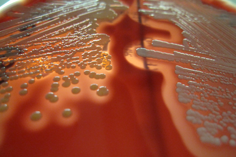 Antibiotics start-up company Auspherix launches Antibiotics start-up company Auspherix launches