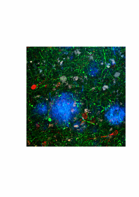 Putting the brain back into brain research