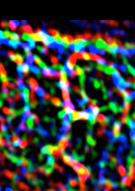 The mechanical forces of metastasis