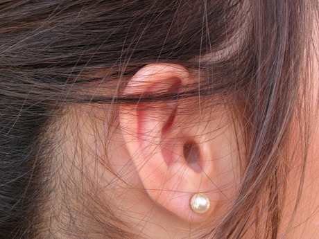 Cochlear cleared to sell new device in US Cochlear cleared to sell new device in US
