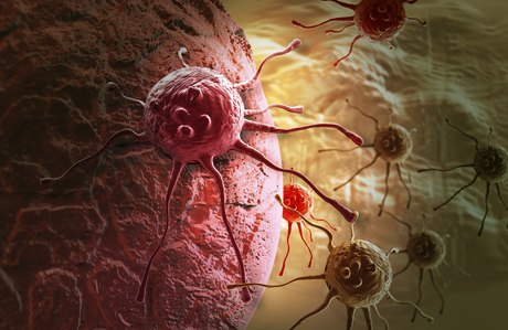 Whole genome sequencing for pancreatic cancer