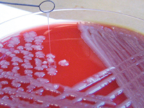 Superbug genome successfully decoded