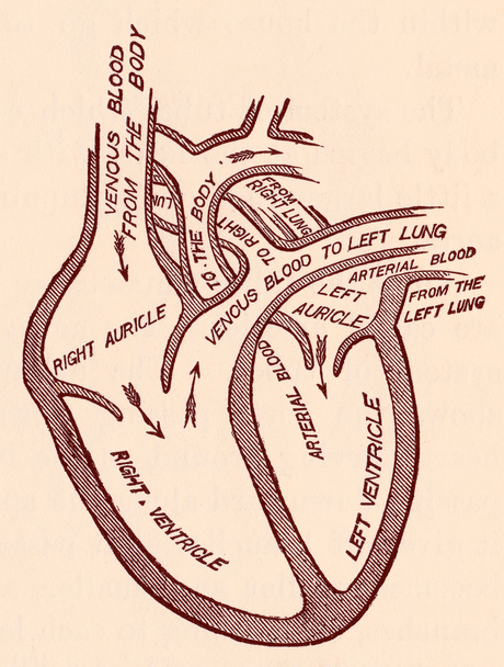 Rheumatoid arthritis and heart valve disease link