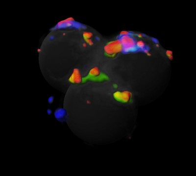 Single-cell genomics to combat inflammation Single-cell genomics to combat inflammation