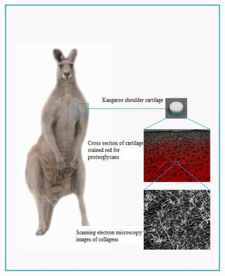 Kangaroo cartilage could improve implants Kangaroo cartilage could improve implants
