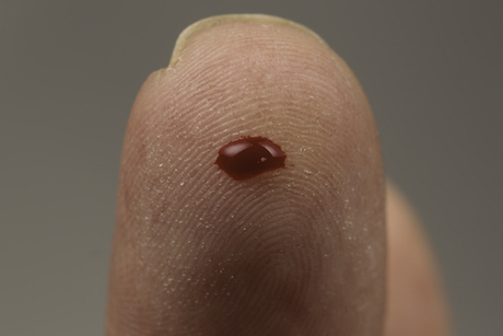 Cancer detection with one drop of blood Cancer detection with one drop of blood