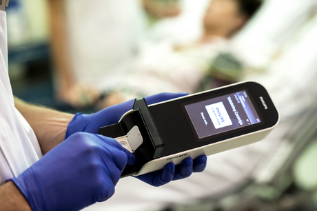 A handheld concussion detection device A handheld concussion detection device