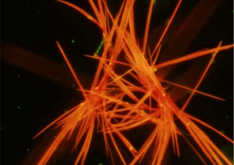 Crystals increase microbes&#39; methane emissions