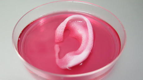 3D printing human tissues 3D printing human tissues