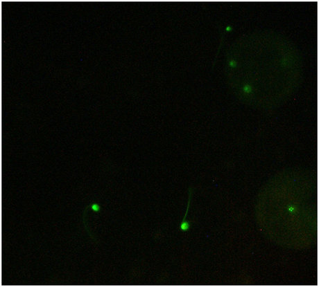 Testing reproductive compatibility with fluorescent sperm