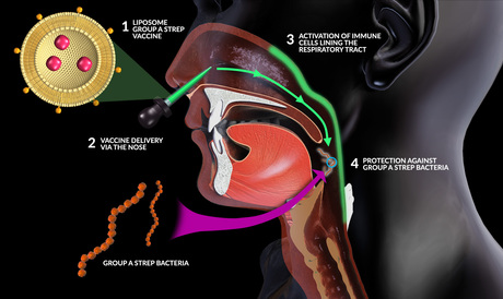 Needle-free vaccine to target strep A infections