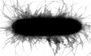 Multi-drug Resistant E.Coli Strain Could Devastate Communities