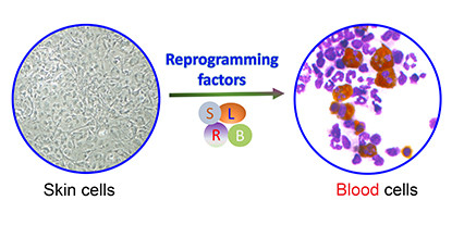 Creating blood from skin cells Creating blood from skin cells
