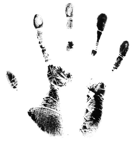 Hand mutilation leads to company conviction