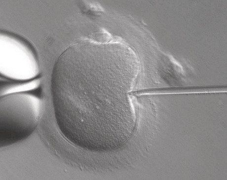 Three-person IVF: mitochondrial donation approved in UK Three-person IVF: mitochondrial donation approved in UK