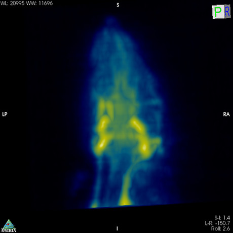 Magnetic particle imaging comes Down Under Magnetic particle imaging comes Down Under