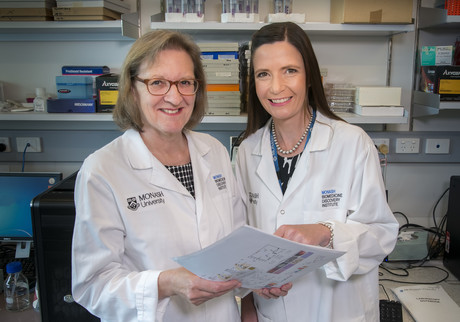 Aggressive prostate cancer secrets revealed