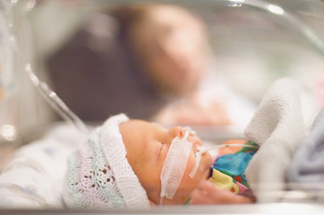 Moderate-to-late premature babies face higher rates of developmental problems