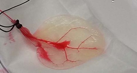 Human heart tissue grown in spinach leaves