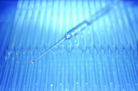 How to choose the right pipette tips for your experiment How to choose the right pipette tips for your experiment
