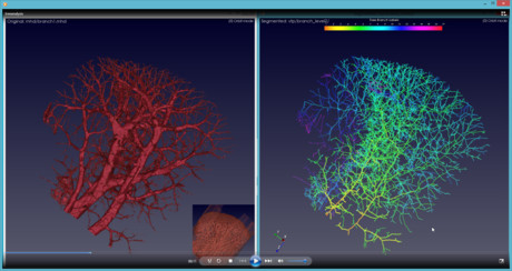 Better blood vessel imaging detects cancer early Better blood vessel imaging detects cancer early