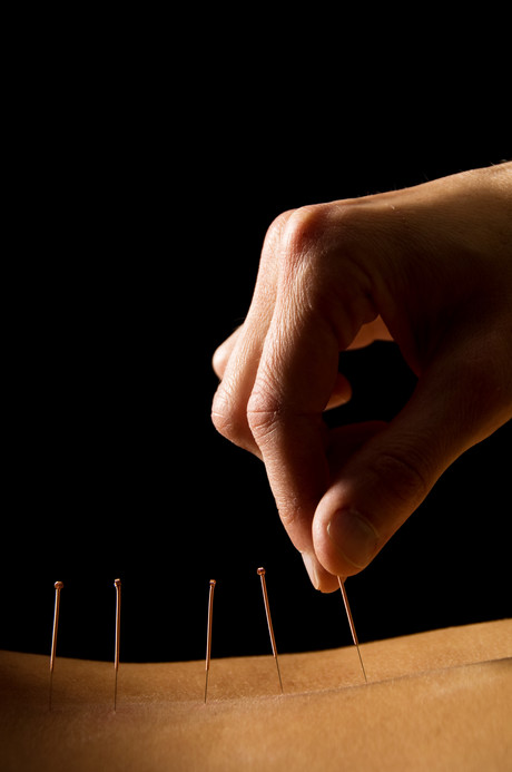 Acupuncture relieves pain in emergency patients