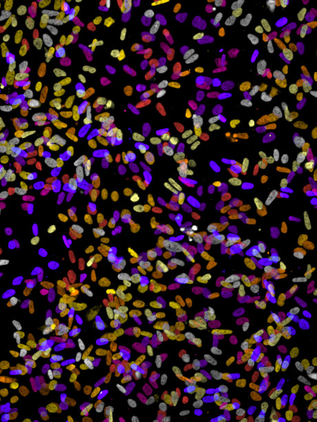 Improved use of existing drugs possible for cancer treatment