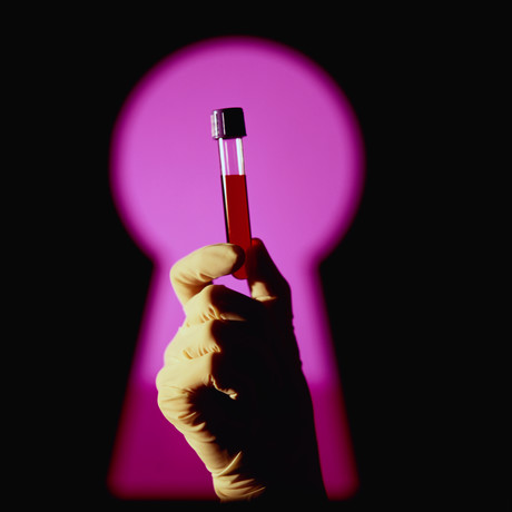 Alzheimer&#39;s diagnosis may soon be possible with a simple blood test