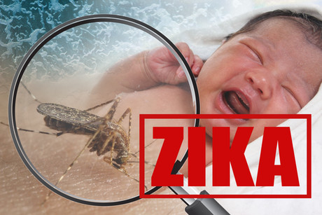 Saliva test key to fast Zika diagnosis Saliva test key to fast Zika diagnosis