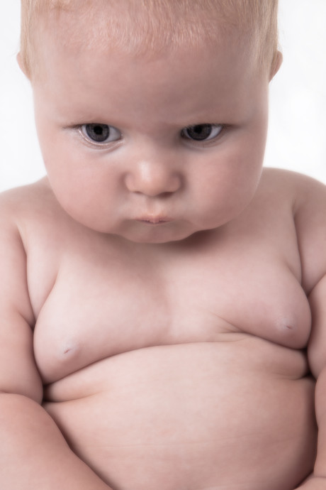 Early pregnancy weight gain linked to childhood obesity