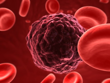 Triggering pigmentation to prevent melanoma Triggering pigmentation to prevent melanoma