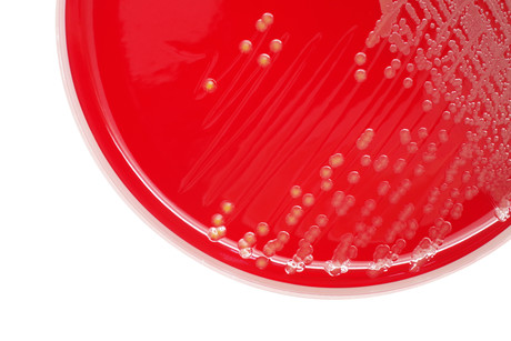 Golden staph more prevalent in community than hospital Golden staph more prevalent in community than hospital