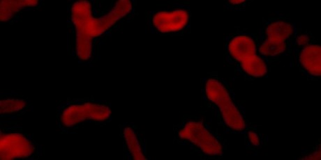 Shape-shifting polymers could improve cancer drug delivery