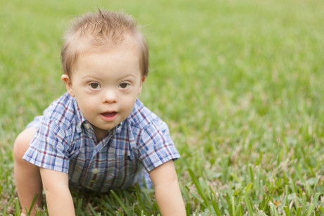 Protein analysis provides new insights into Down syndrome Protein analysis provides new insights into Down syndrome