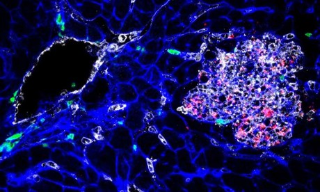 Napping <em>Listeria</em>: bacteria that hide in cells