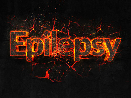 Epilepsy seizure prediction possible with AI