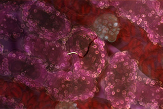 Malaria mystery solved