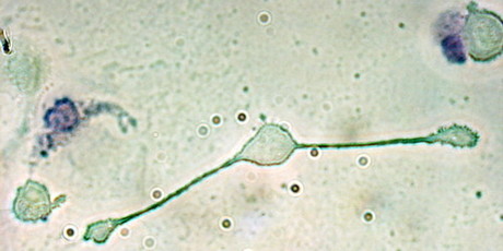 Training the innate immune system to remember past threats