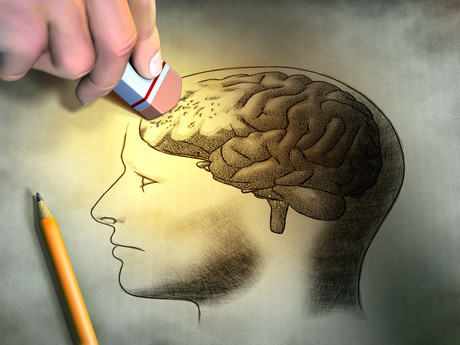 Alzheimer's blood test predicts beta-amyloid in the brain Alzheimer's blood test predicts beta-amyloid in the brain