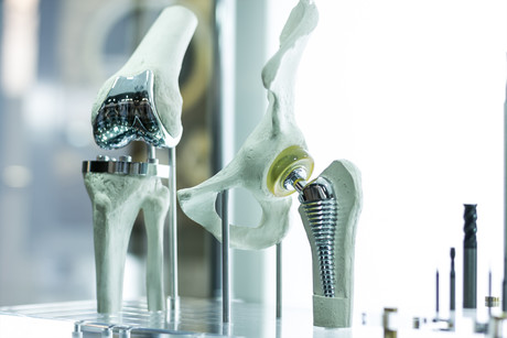1 in 4 joint replacement surgeries unnecessary 1 in 4 joint replacement surgeries unnecessary