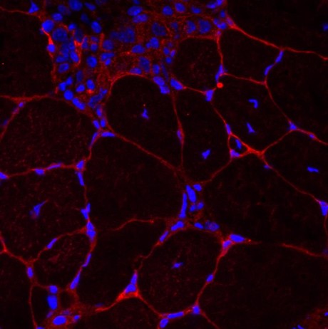3D scaffolds to grow muscle
