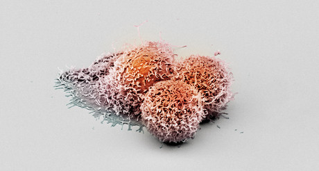 New anticancer protein found to suppress liver tumours