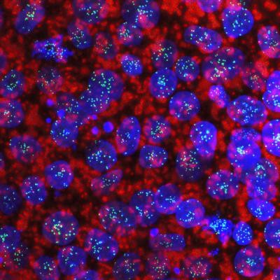 Human &#39;gene atlas&#39; created using stem cells