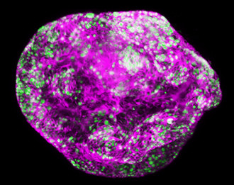 Cancer prevention gene the &#39;odd one out&#39; in its family