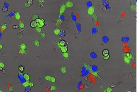 &#39;Bystander killing&#39; eliminates rogue cancer cells