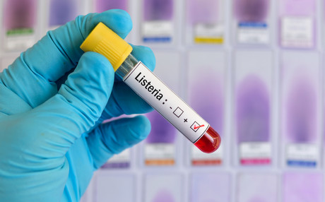 27% mortality in world&#39;s largest ever listeriosis outbreak