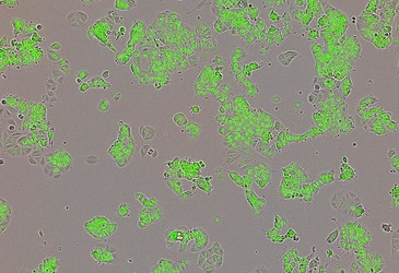 Yin Yang protein may fuel breast cancer growth Yin Yang protein may fuel breast cancer growth