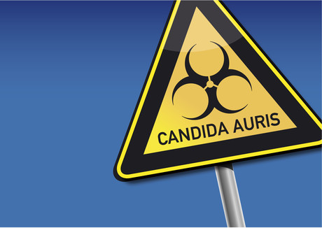 Multiresistant superbug appears in Australia Multiresistant superbug appears in Australia